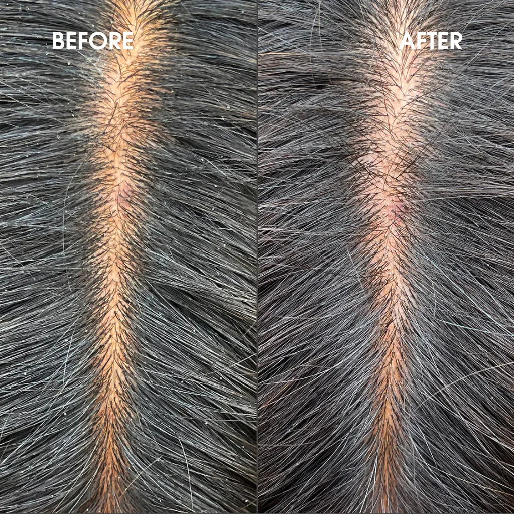 Briogeo Scalp Revival Charcoal + Tea Tree Cooling Hydration Scalp Mask - MANEPRINT