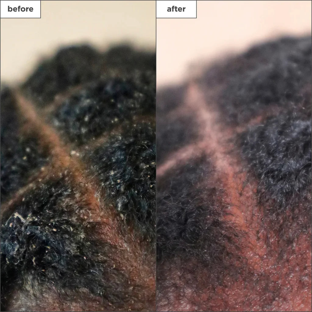 Briogeo Scalp Treatment Drops - MANEPRINT