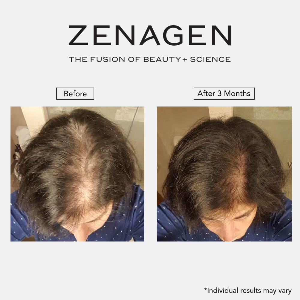 Revolve 16oz Women's Duo