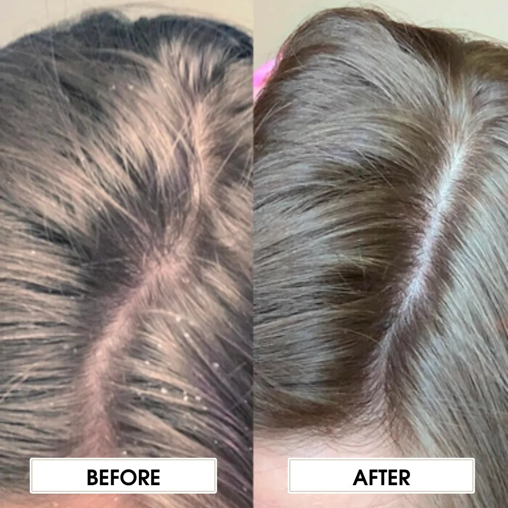 L'ANZA Scalp Balancing Shampoo - MANEPRINT