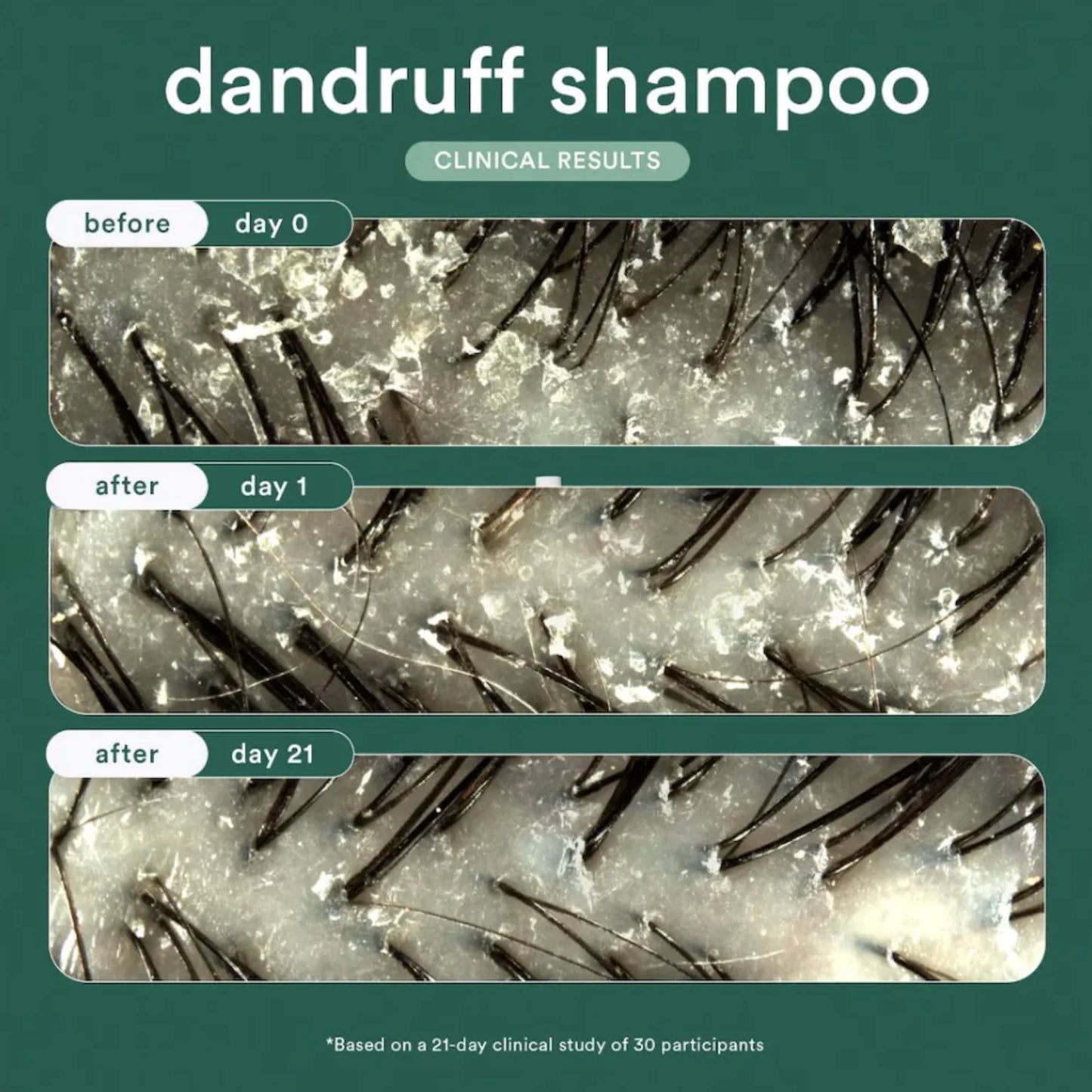 Verb Dandruff Shampoo