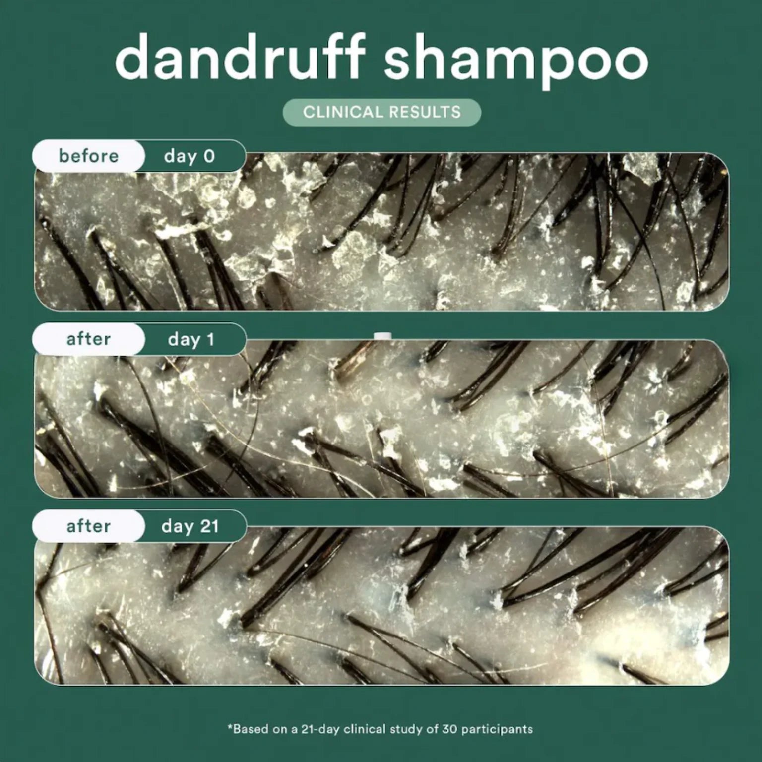 Verb Dandruff Shampoo - MANEPRINT