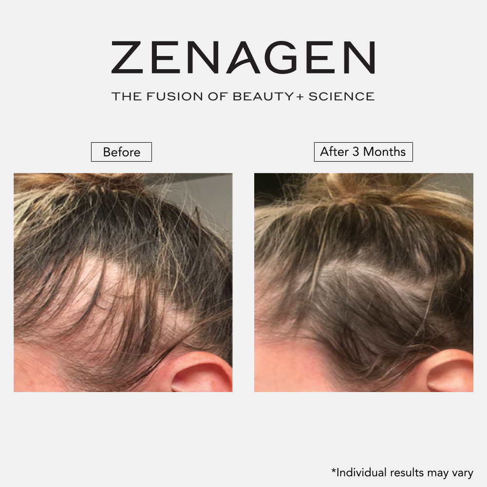 Revolve 16oz Women's Duo