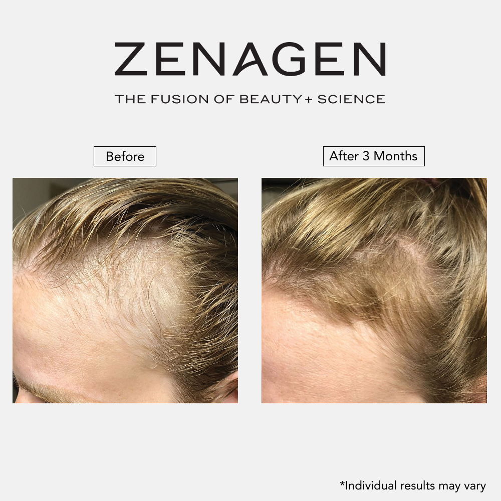 Revolve 16oz Women's Duo