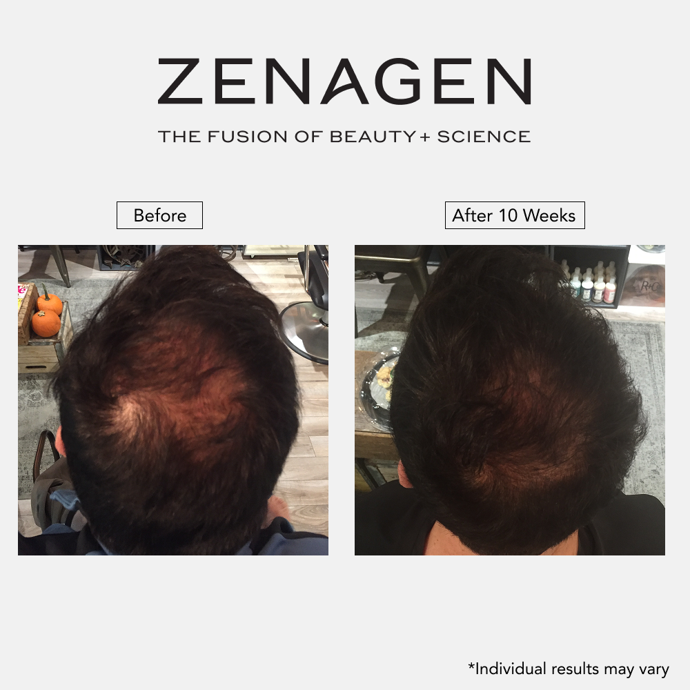 Revolve Thickening Shampoo for Men