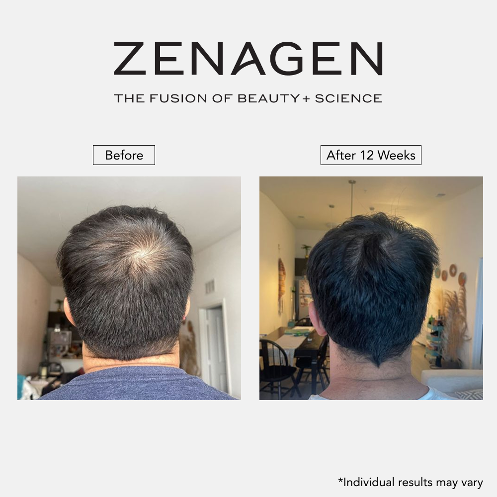 Revolve Thickening Shampoo for Men