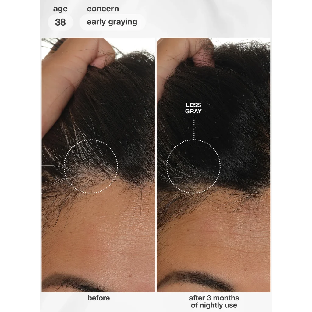 Before-and-after comparison of a person's hair at the crownline, showing early gray hair at age 38 labeled 'before' and darker, less gray hair after 3 months of nightly use labeled 'after'. MANEPRINT