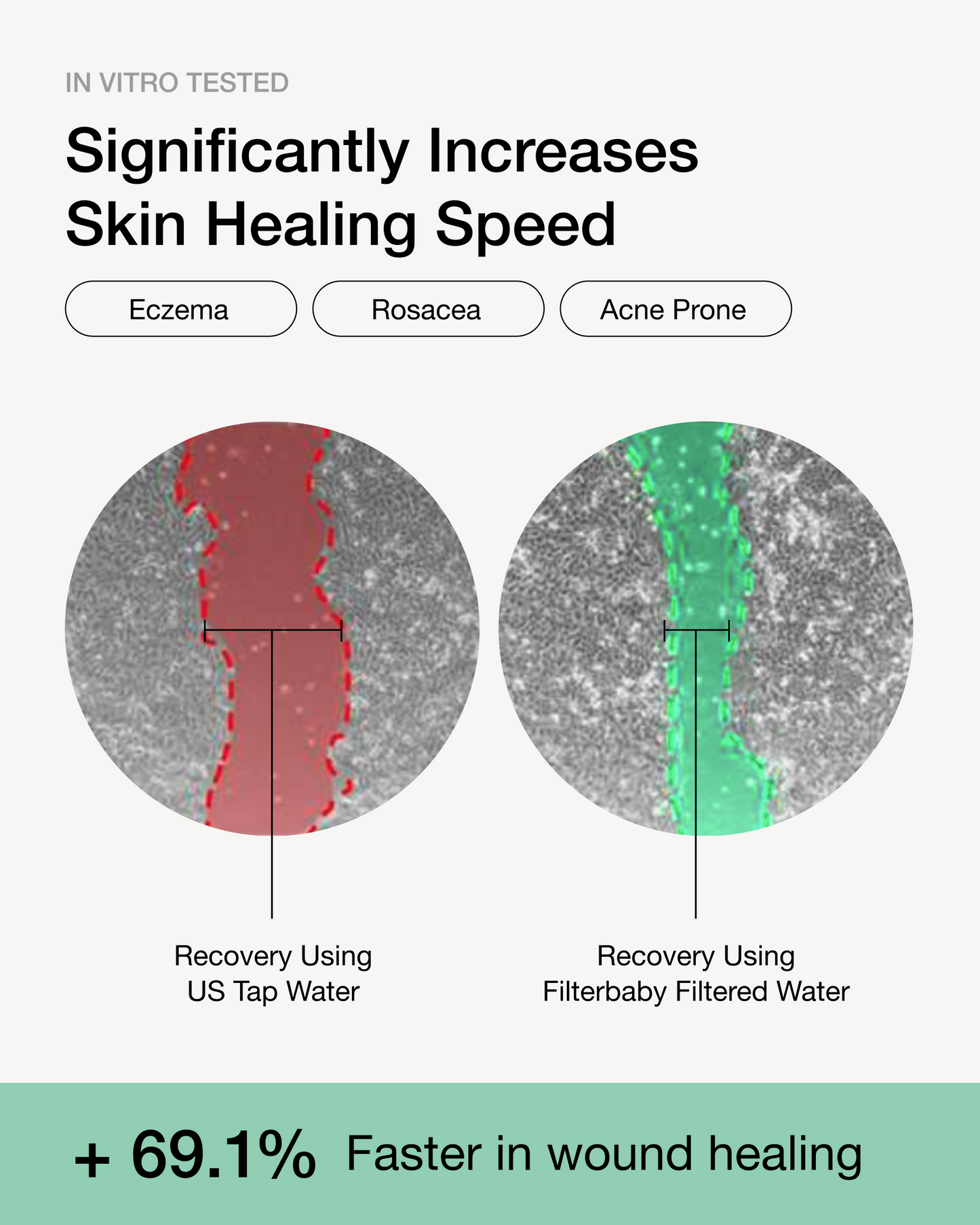 Filterbaby Skincare Filter 2.0