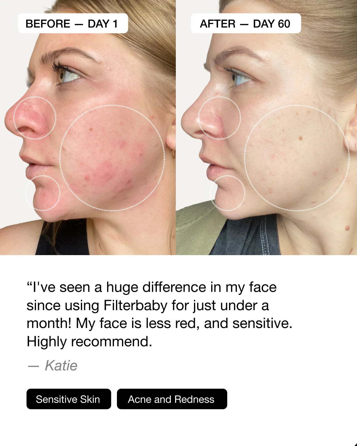 Filterbaby Skincare Filter 2.0