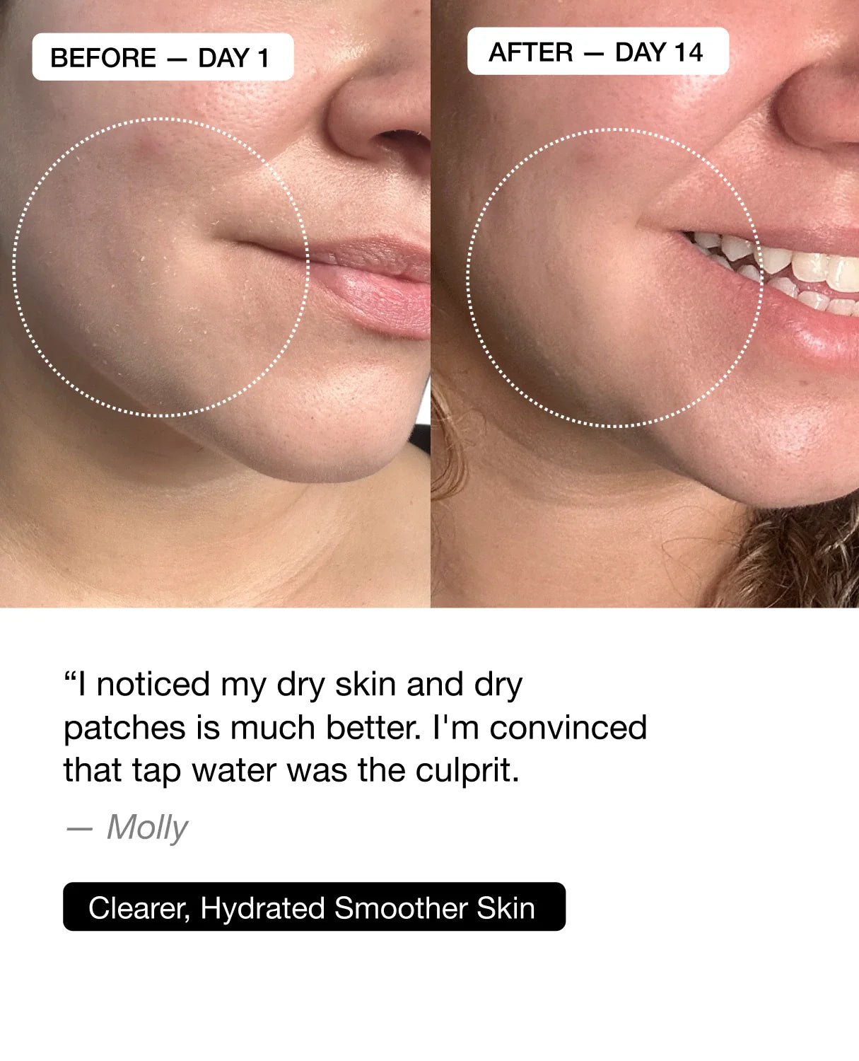 Filterbaby Skincare Filter 2.0