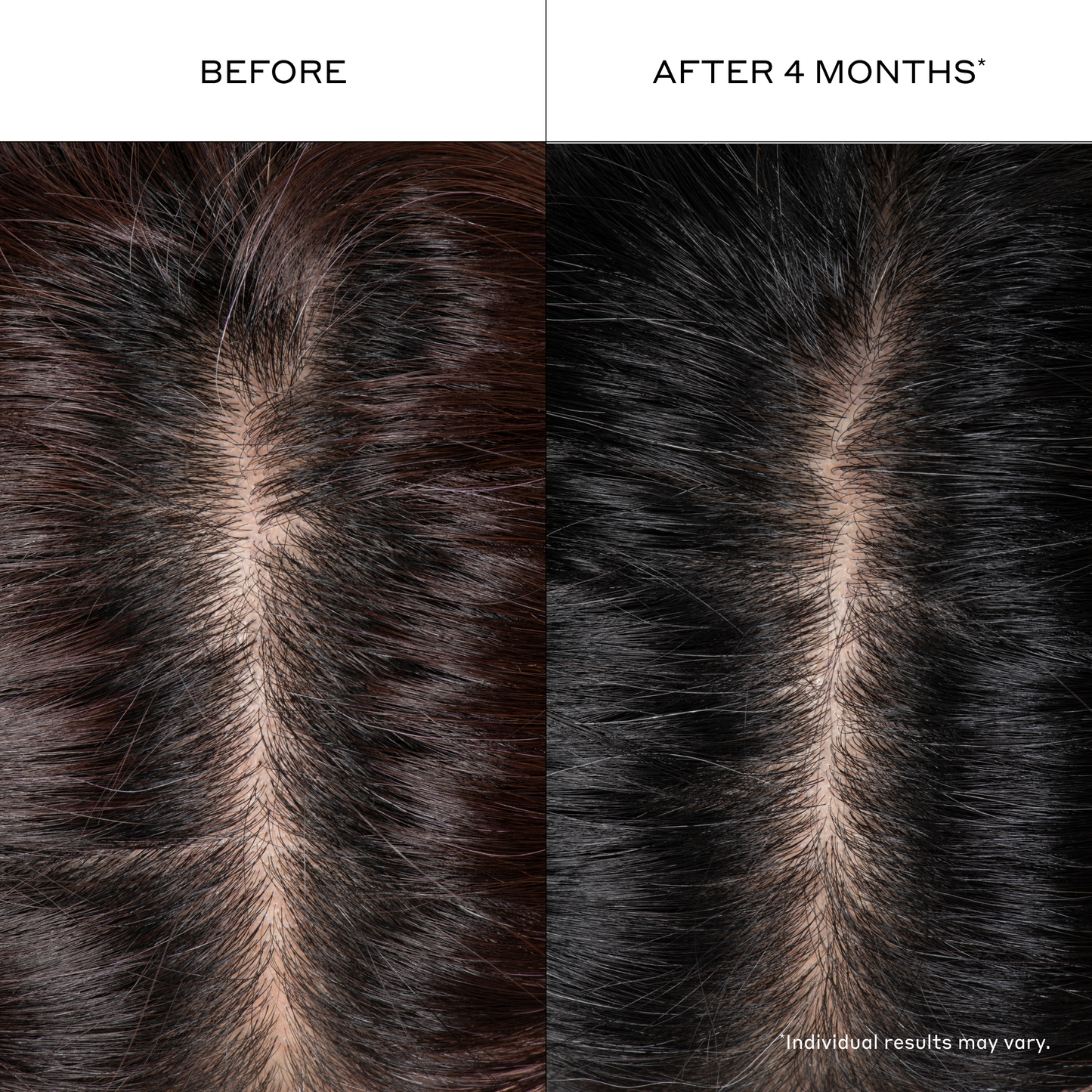Densifying Hair Serum