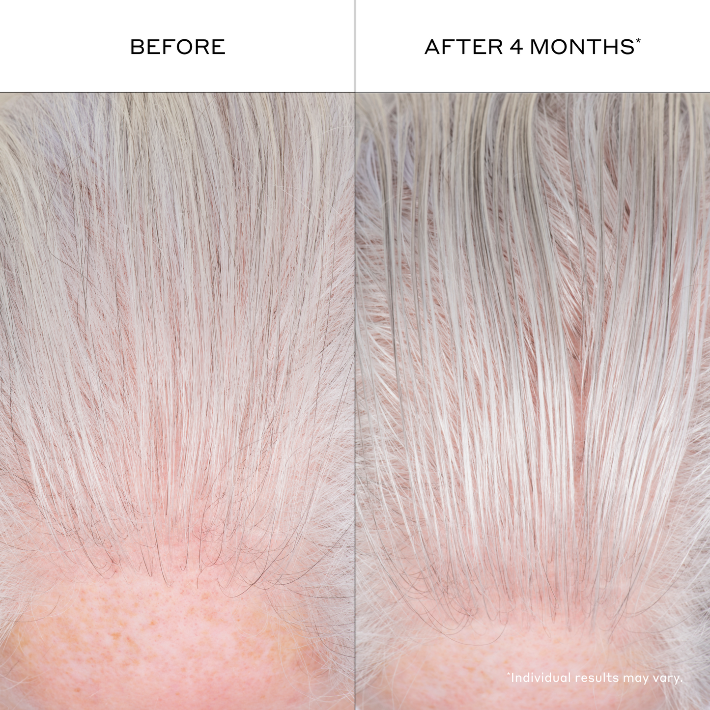 Densifying Hair Serum