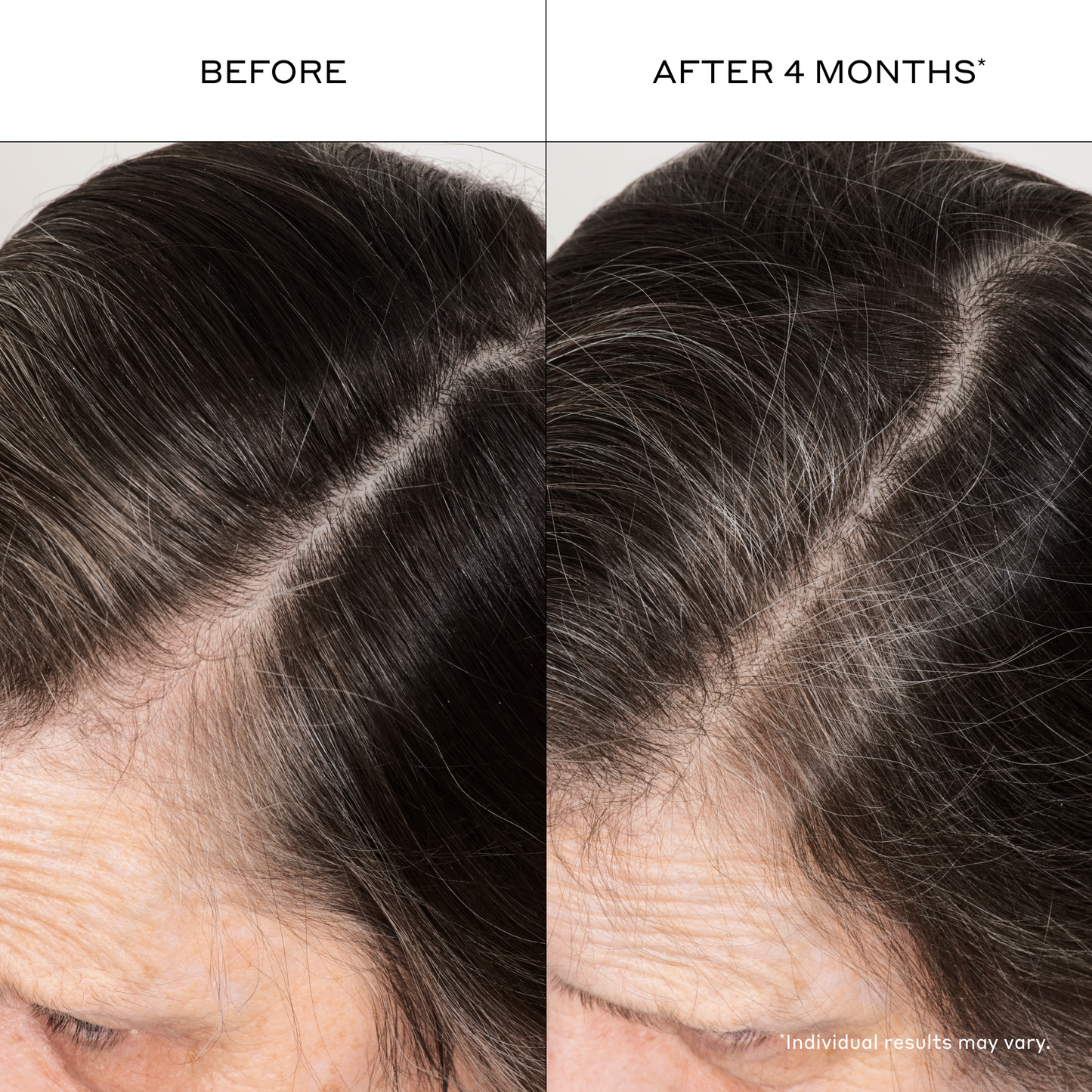 Densifying Hair Serum