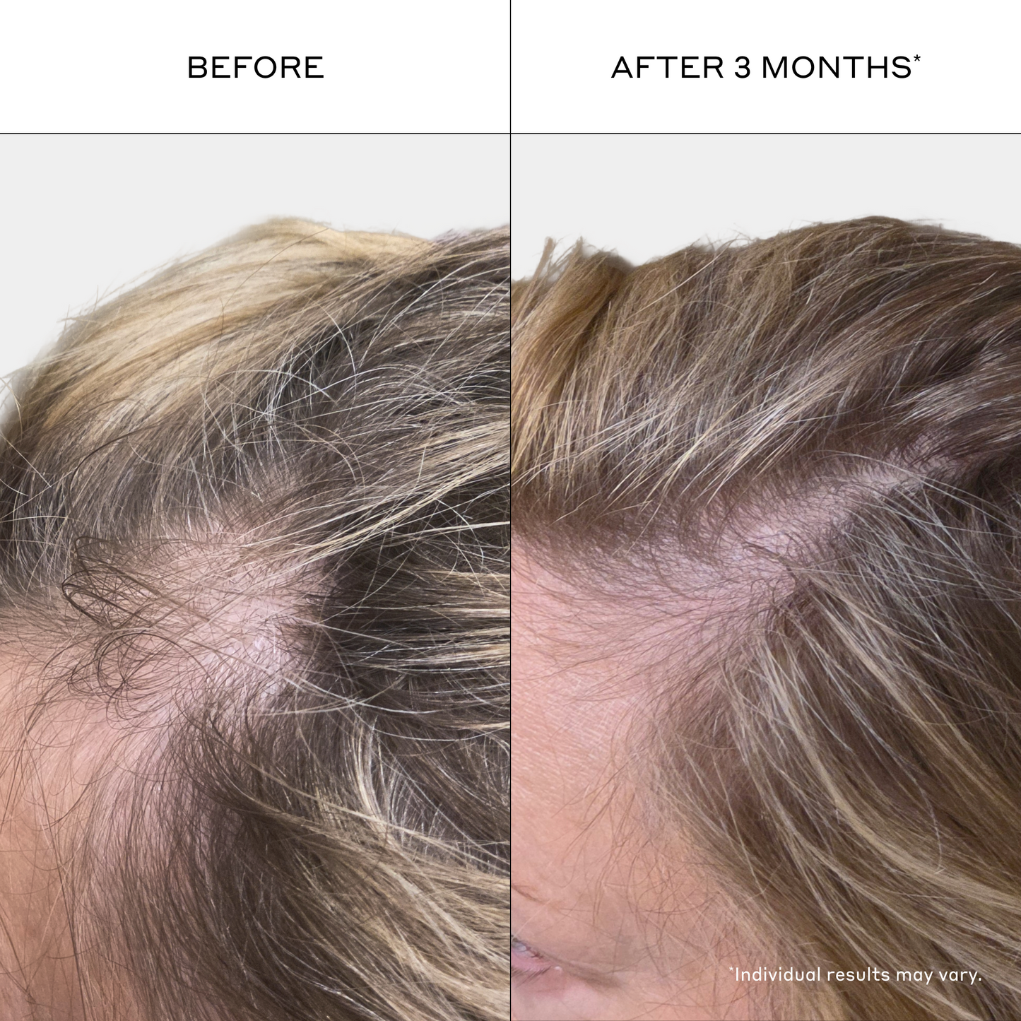 Revolve Thickening Shampoo for Women