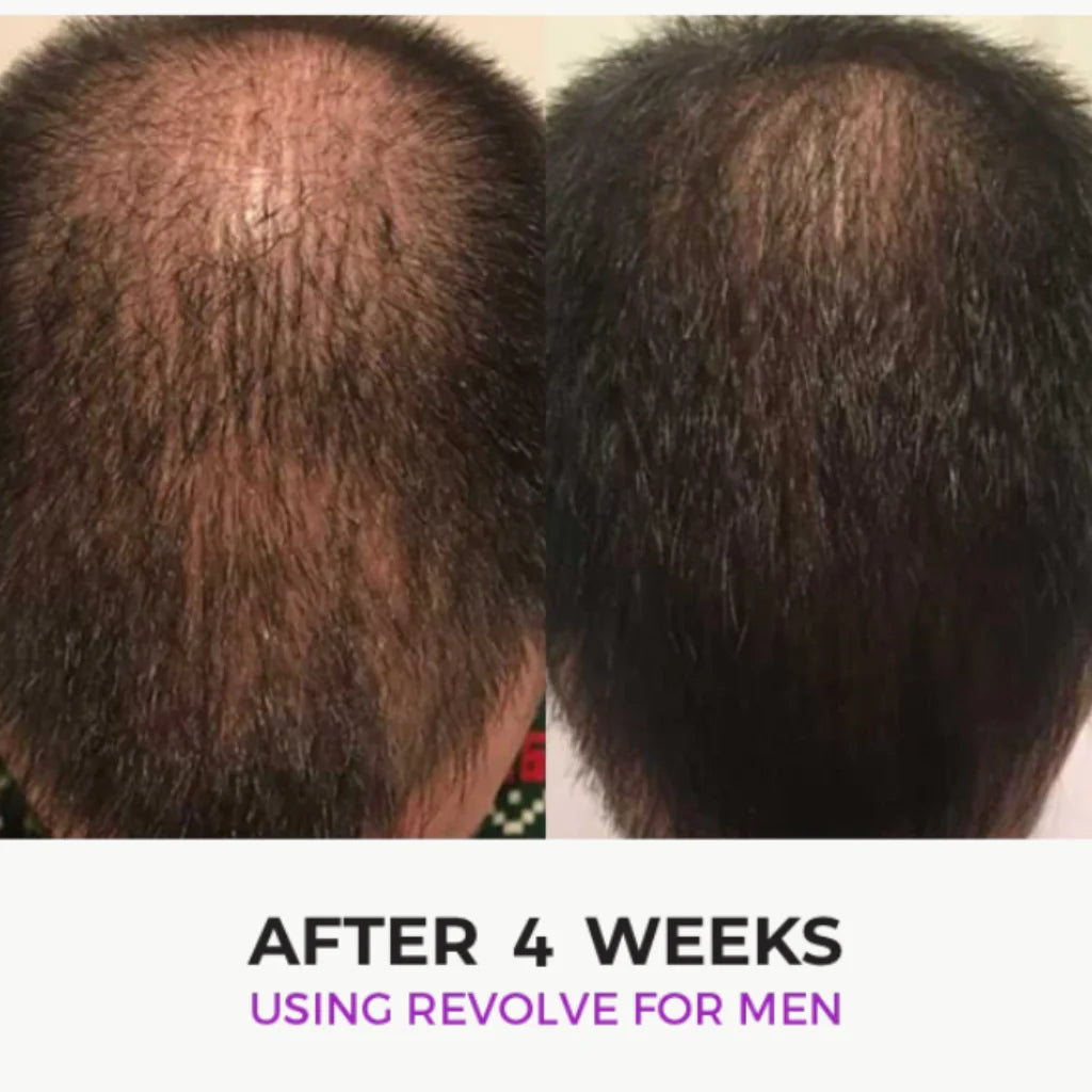 Zenagen Revolve Hair Loss Shampoo Treatment - MANEPRINT