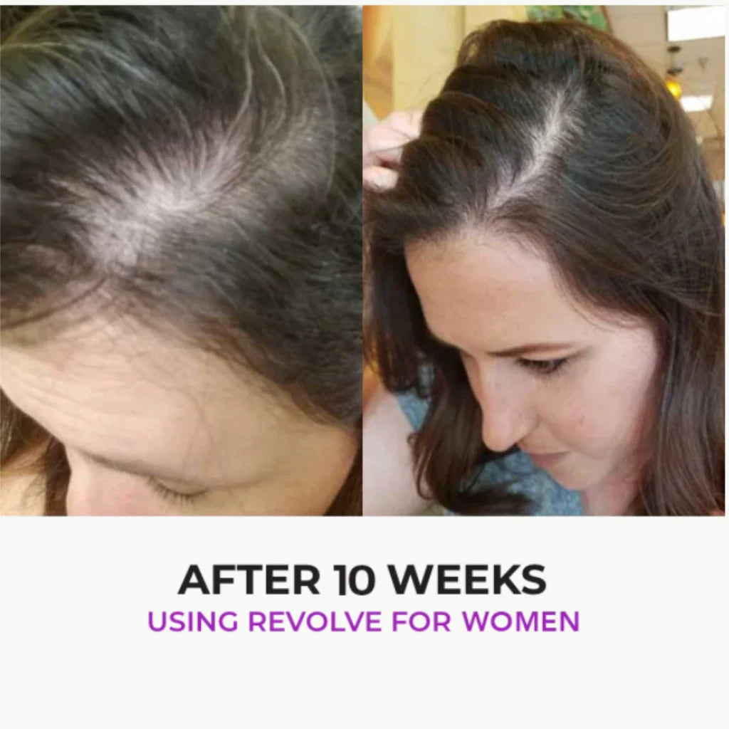 Zenagen Revolve Hair Loss Shampoo Treatment - MANEPRINT