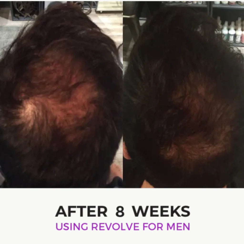 Zenagen Revolve Hair Loss Shampoo Treatment - MANEPRINT